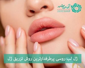 تزریق ژل لب روسی در جهانشهر کرج