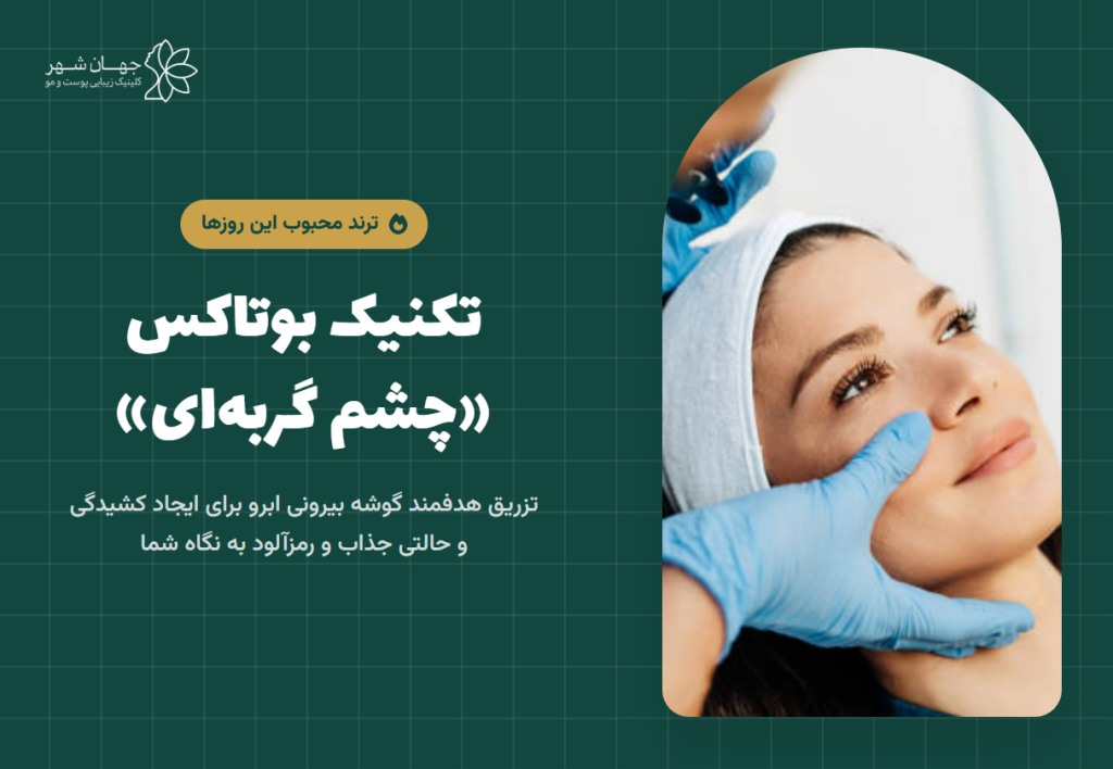 بوتاکس دور چشم گربه‌ای