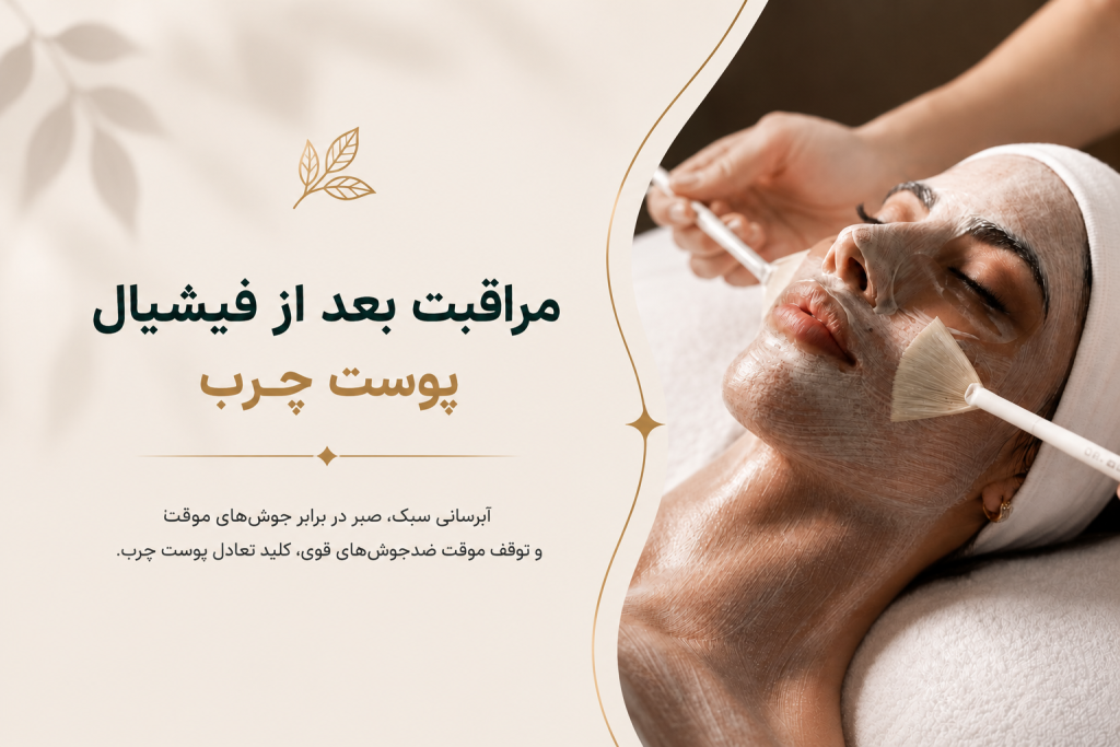 مراقبت بعد از فشیال پوست چرب