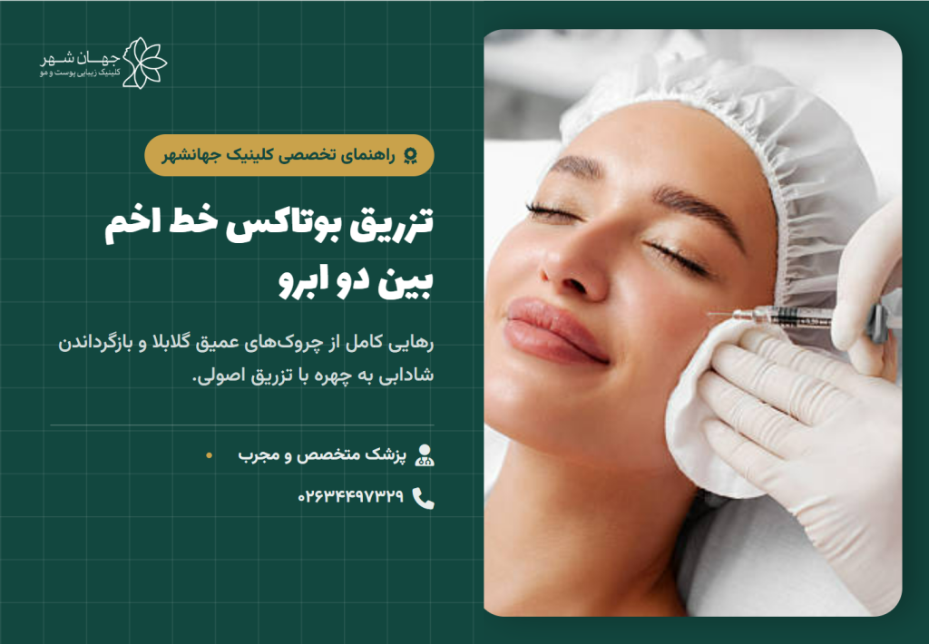 بوتاکس خط اخم بین دو ابرو