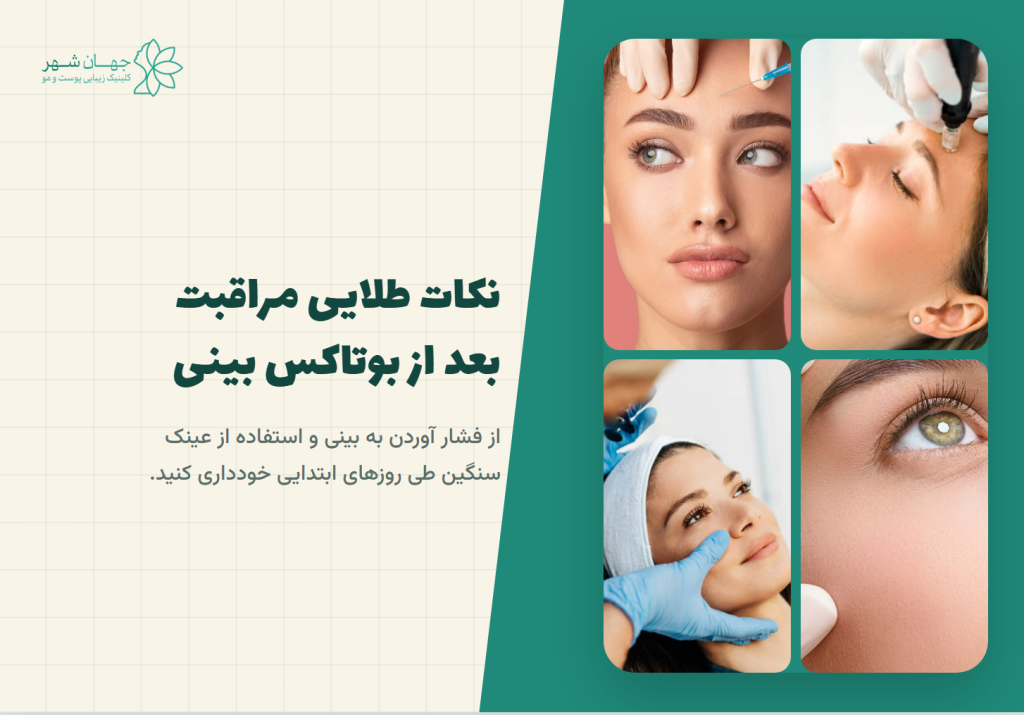 نکات طلایی مراقبت بعد از بوتاکس بینی