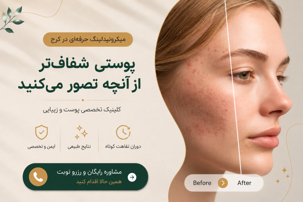 مراقبت بعد از میکرونیدلینگ کرج-cta