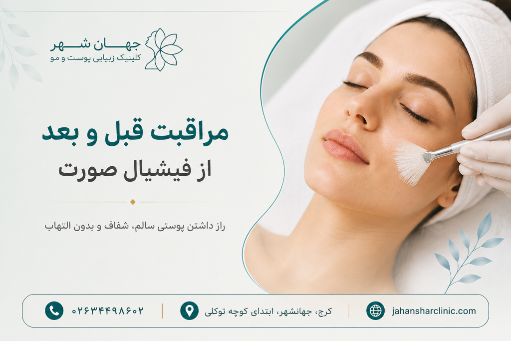 مراقبت قبل و بعد از فیشیال