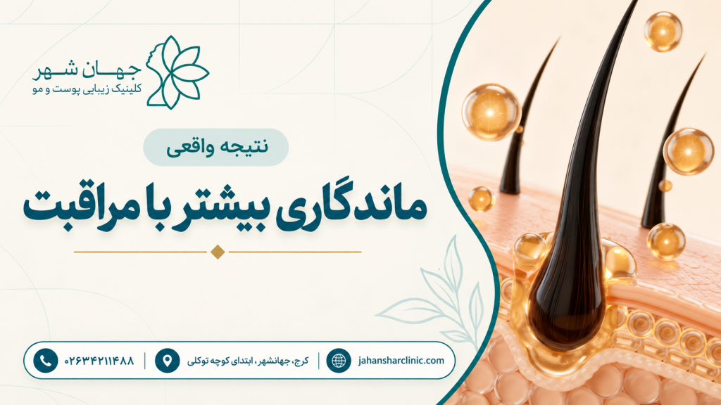 چه قدر ماندگاری دارد